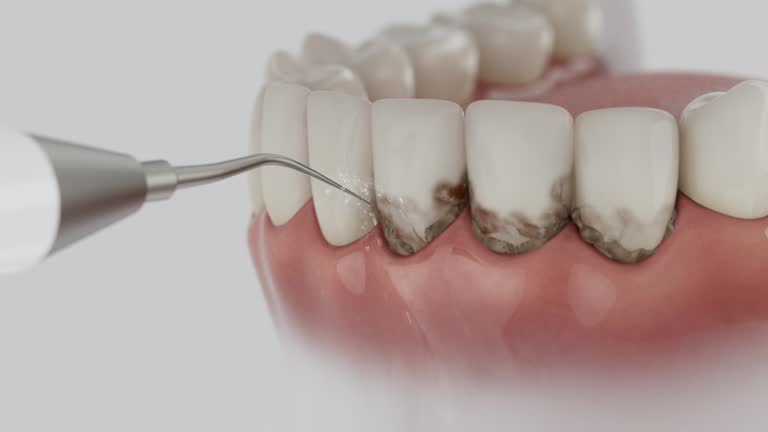 Reliable Emergency Dentist contractor in Moniteau County County, MO by Dentist Open Now